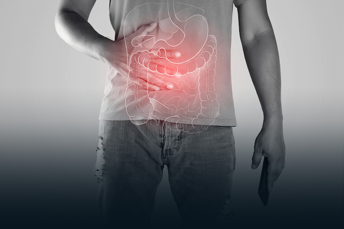 câncer de intestino