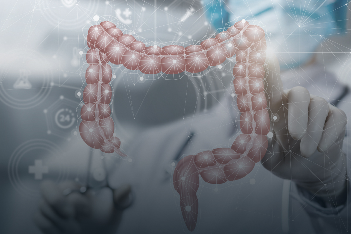 câncer de intestino